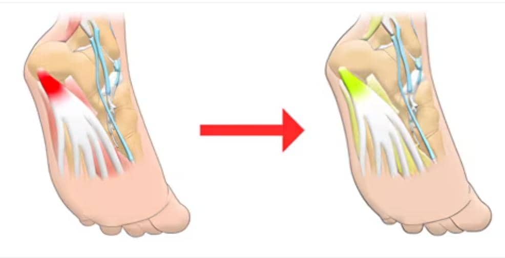 Semelles OrthoFlex™