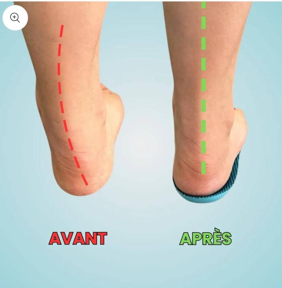 Semelles OrthoFlex™